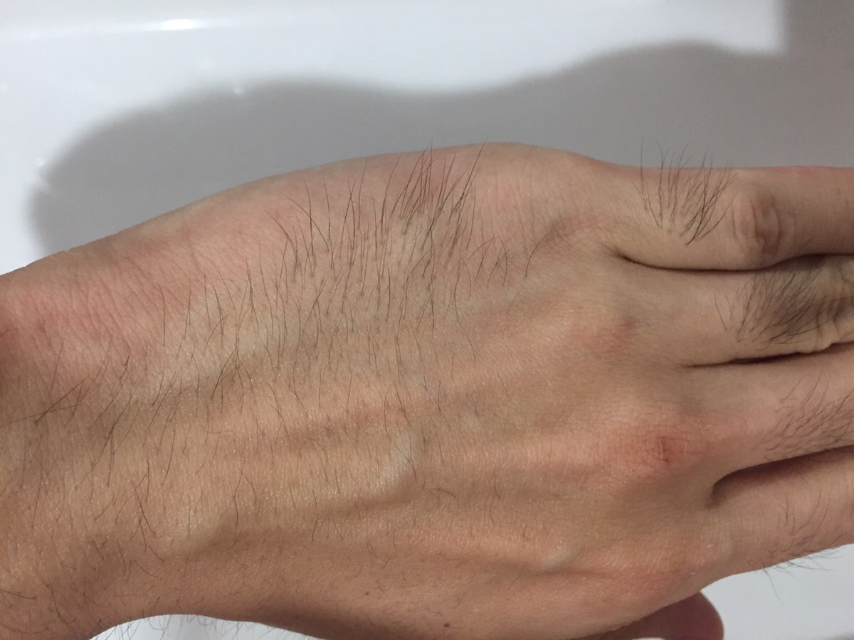 まずはパッチテスト