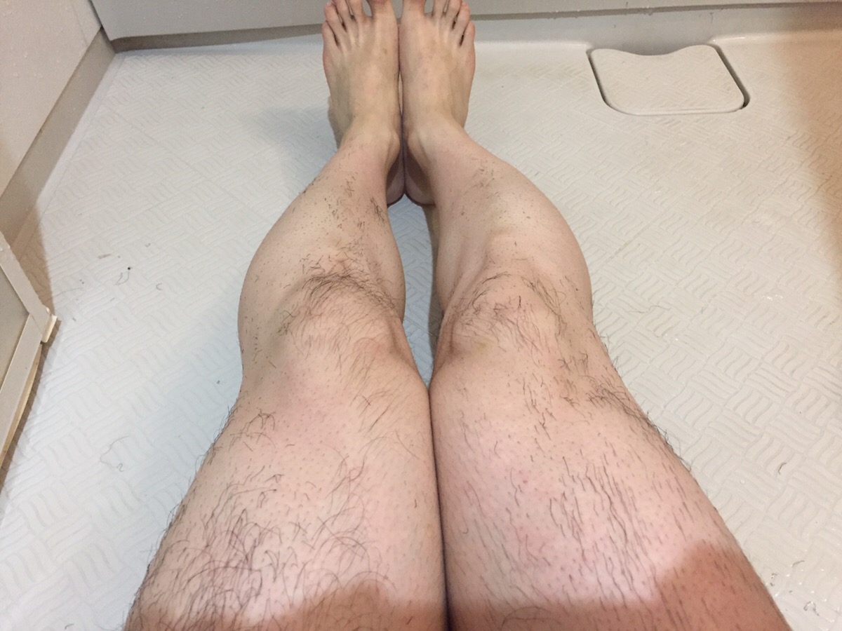 除毛スプレー失敗