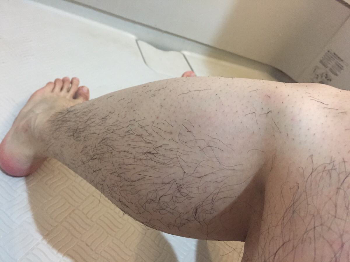 脱毛スプレー