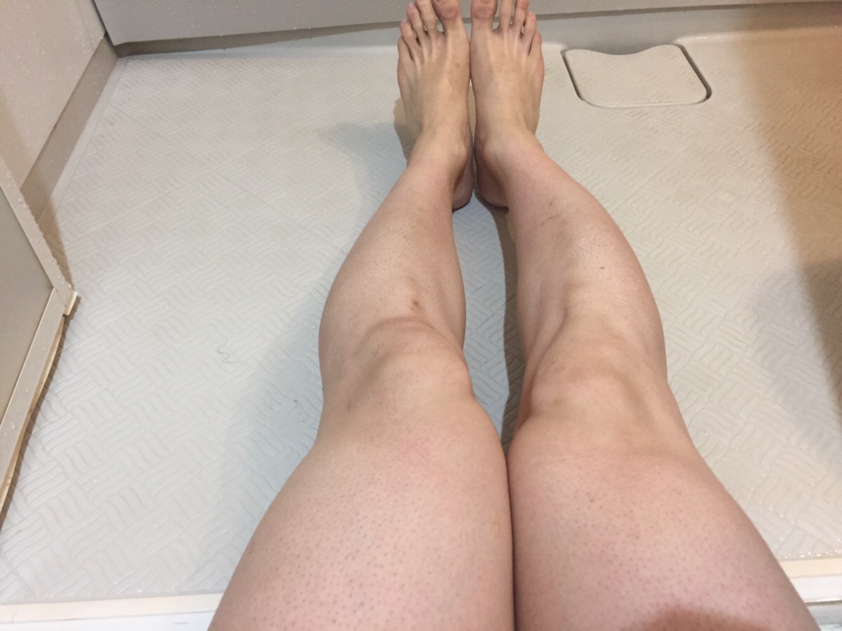 カミソリで処理