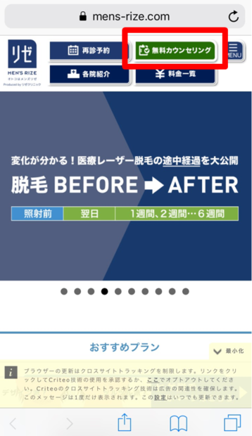 メンズリゼクリニックの無料カウンセリング