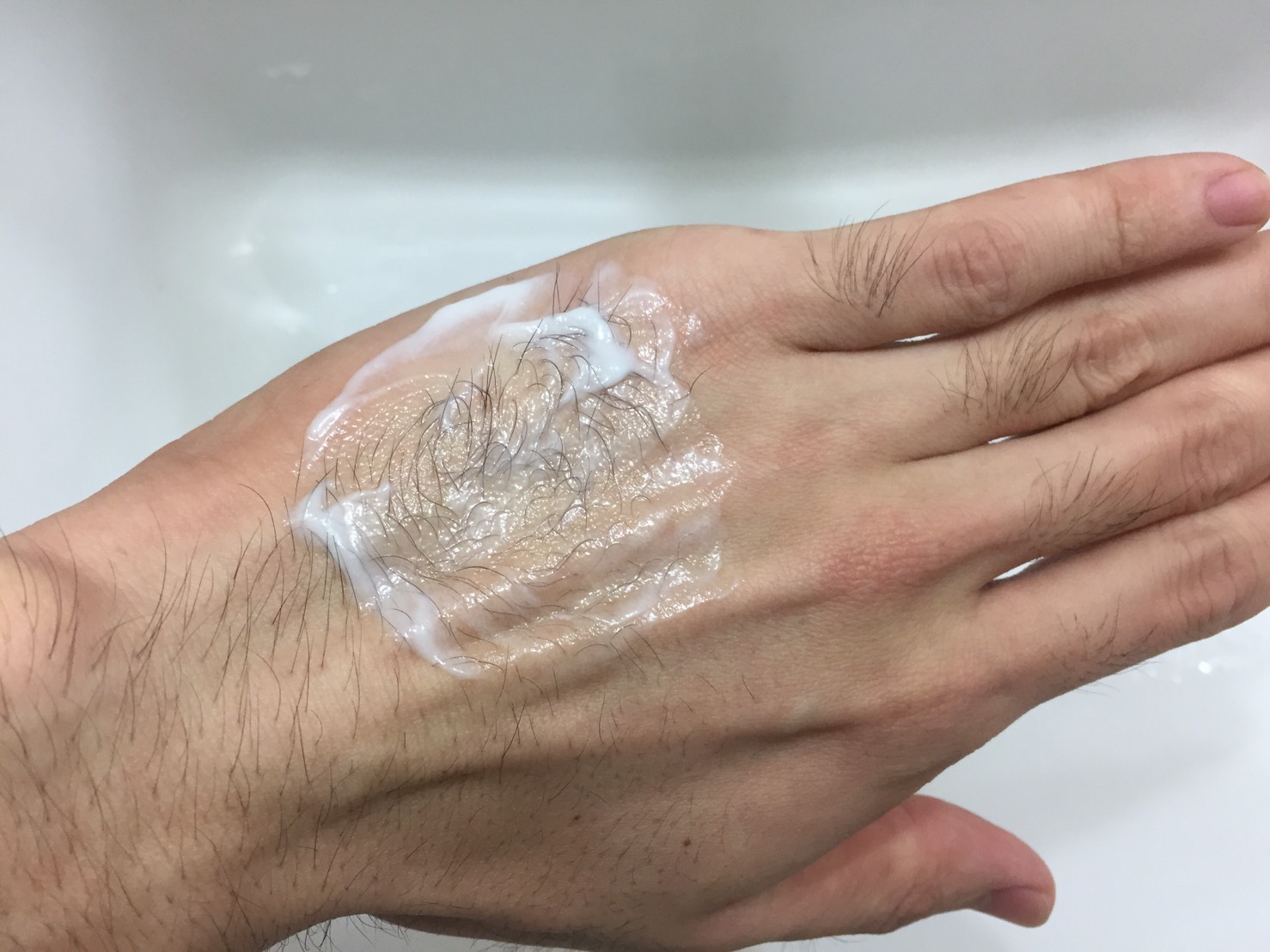 手の甲でパッチテストを行っている様子