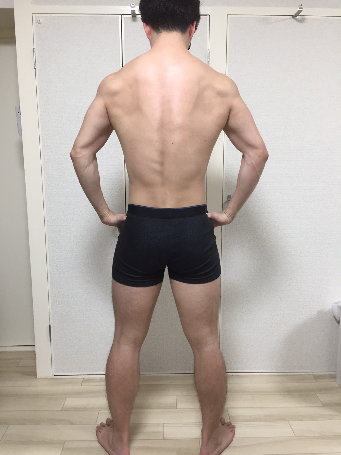 除毛を行う前の身体の様子(背面)