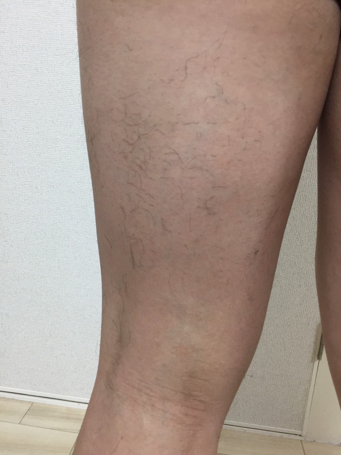 左足の裏に毛が残っている様子